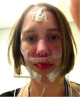 Brooke at a sleep clinic - selfie with tape on her face